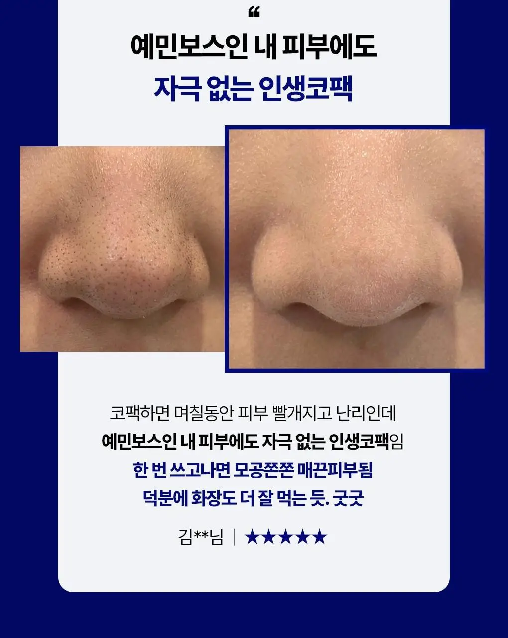 [스패츌러 증정] 메디힐 블랙헤드 멜팅 클리어 코팩 4매 피지연화 상세페이지 10
